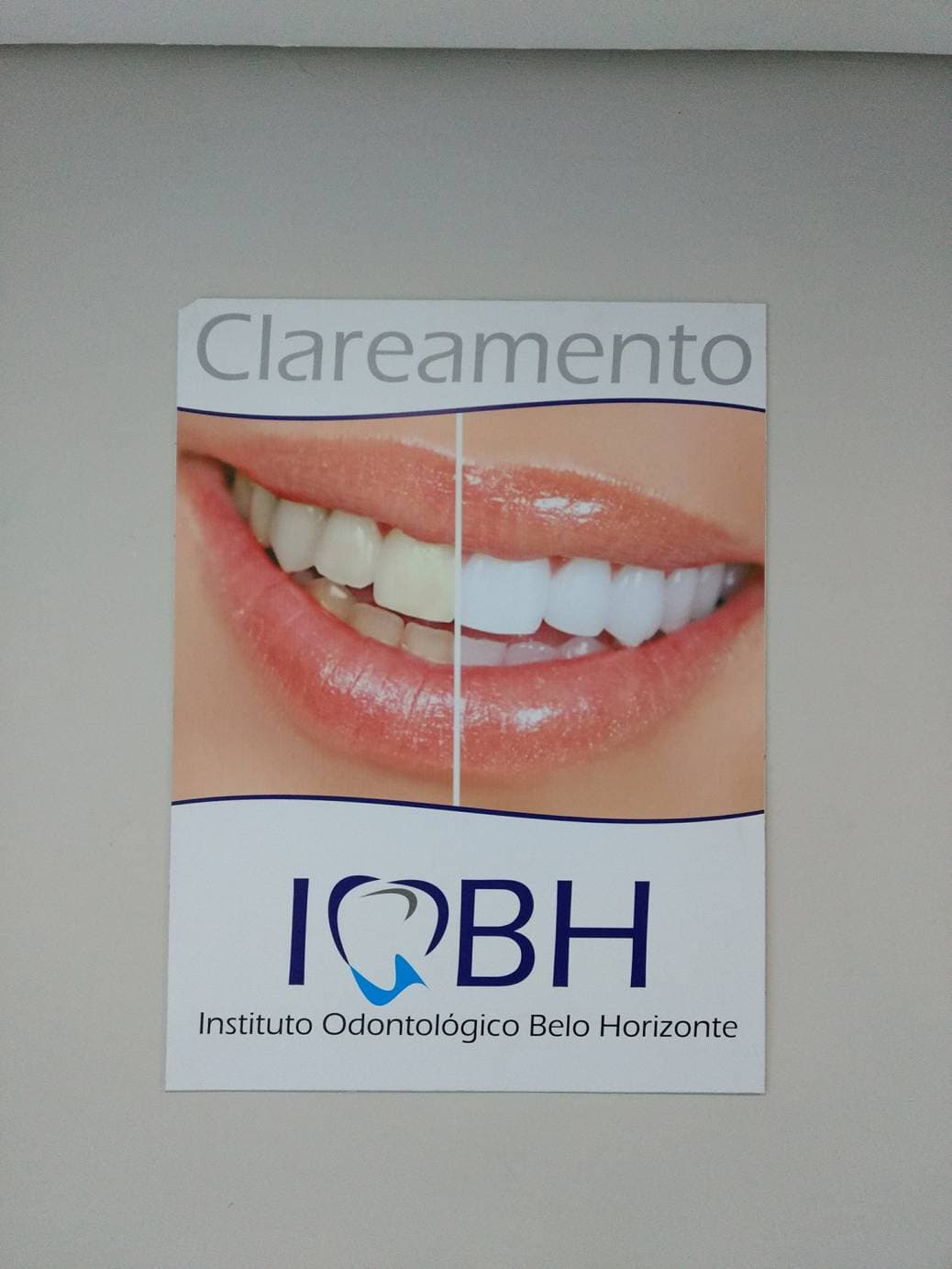 Banner de destaque para os tratamentos de clareamento dental do Instituto Odontológico Belo Horizonte